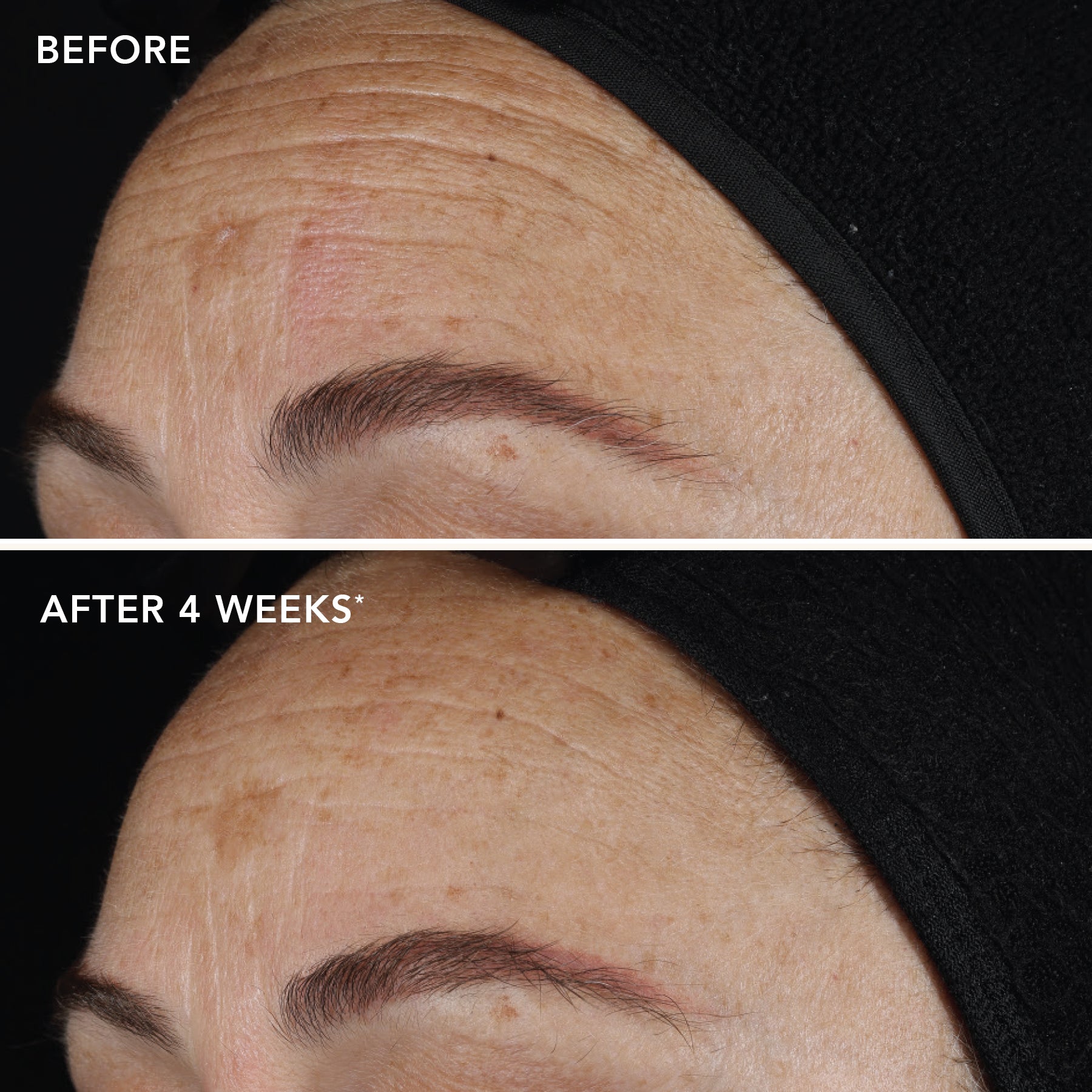 AGELESS+ retinol pure liquid retinol 0.3% travel size