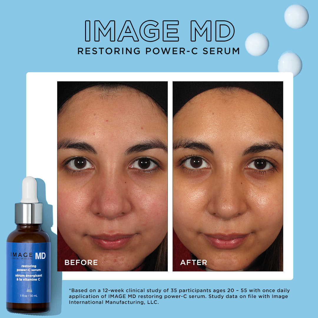 IMAGE MD® restoring power-C serum